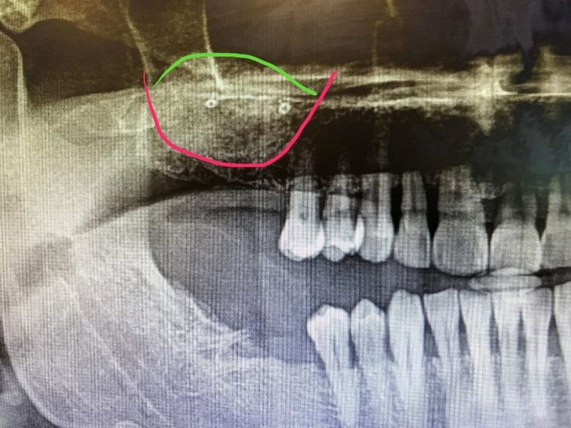 After Treatment Pictures